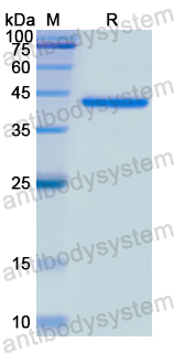 Recombinant Human AGL Protein, N-His