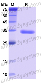 Recombinant Human MYH10 Protein, N-His