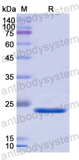 Recombinant Human TIE1 Protein, N-His