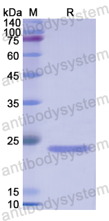 Recombinant Human TIMP3 Protein, N-His