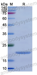 Recombinant Human CHOP/GADD153/DDIT3 Protein, N-His