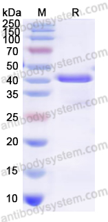 Recombinant Human ATP7B Protein, N-His