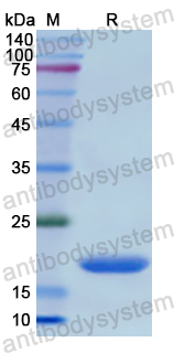 Recombinant Human HNF1B Protein, N-His