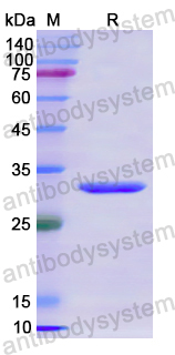 Recombinant Human SOX5 Protein, N-His