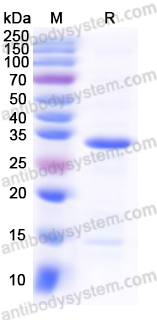 Recombinant Human AHR Protein, N-His