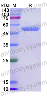 Recombinant Human KRT20 Protein, N-His