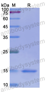 Recombinant Human KRT2 Protein, N-His