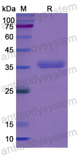 Recombinant Human FLT4 Protein, N-His