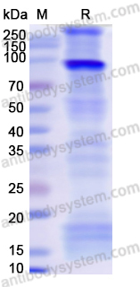 Recombinant Human CD309/KDR/VEGFR-2 Protein, N-His