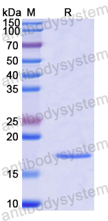 Recombinant Human SLC16A2 Protein, N-His-SUMO