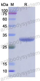 Recombinant Human CHI3L1 Protein, N-His