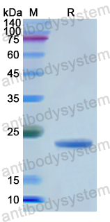 Recombinant Human GGT5 Protein, N-His