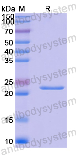 Recombinant Human TCF7 Protein, N-His-SUMO
