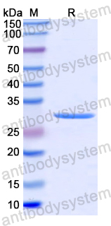 Recombinant Human MAP2K2 Protein, N-His