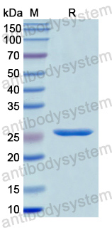 Recombinant Human PGM1 Protein, N-His