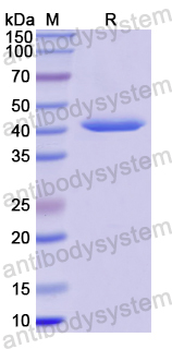 Recombinant Human CD135/FLT3 Protein, N-His