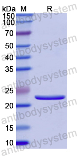 Recombinant Human SERPINB5 Protein, N-His