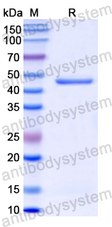 Recombinant Human SERPINF1/PEDF/Serpin F1 Protein, N-His