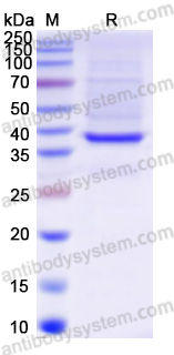 Recombinant Human GPX4 Protein, N-GST