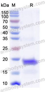 Recombinant Human TGFBR2/TGFR-2 Protein, N-His