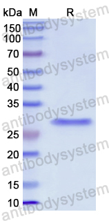 Recombinant Human NUP62 Protein, N-His