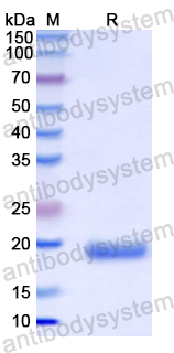 Recombinant Human FDFT1 Protein, N-His