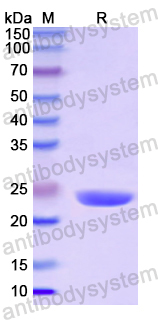 Recombinant Human TAGLN2 Protein, N-His