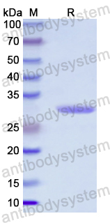 Recombinant Human ETFB Protein, N-His