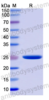 Recombinant Human COIL Protein, N-His