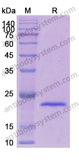 Recombinant Human CDKN1A Protein, N-His