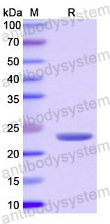 Recombinant Human COL15A1 Protein, N-His