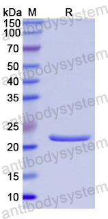 Recombinant Human COL18A1 Protein, N-His