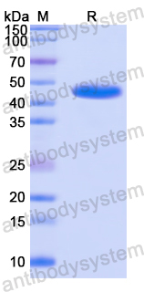 Recombinant Human DDOST Protein, N-His