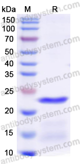 Recombinant Human MMP12 Protein, N-His