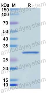 Recombinant Human DCT Protein, N-His