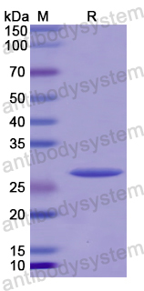 Recombinant Human CD42d/GP5 Protein, N-His