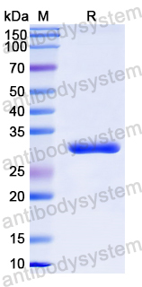 Recombinant Human NNMT Protein, N-His