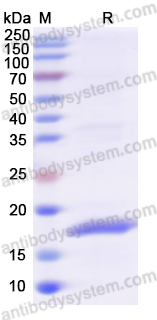 Recombinant Human VHL Protein, N-His