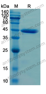 Recombinant Human MLH1 Protein, N-His