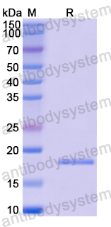 Recombinant Human USP8 Protein, N-His