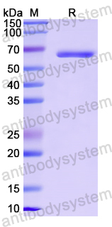 Recombinant Human MDH1 Protein, N-GST