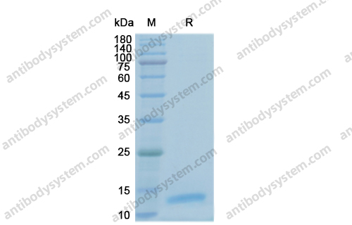 Recombinant Human IL15 Protein, C-His