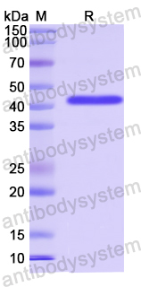 Recombinant Human ETV5/ERM Protein, N-His