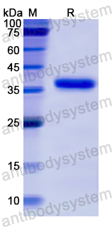 Recombinant Human AQP2 Protein, N-GST