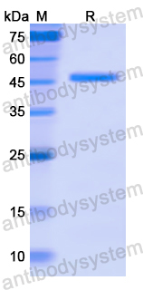 Recombinant Human BCL6 Protein, N-His