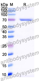 Recombinant Human BCL6 Protein, N-His-SUMO