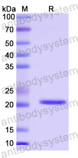 Recombinant Human CETN2 Protein, N-His