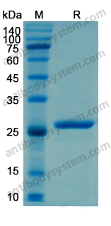 Recombinant Human CD200 Protein, N-His