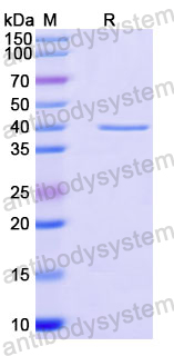 Recombinant Human PRPH Protein, N-His