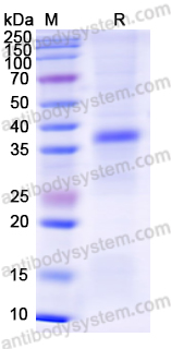 Recombinant Human WNT5A Protein, N-His